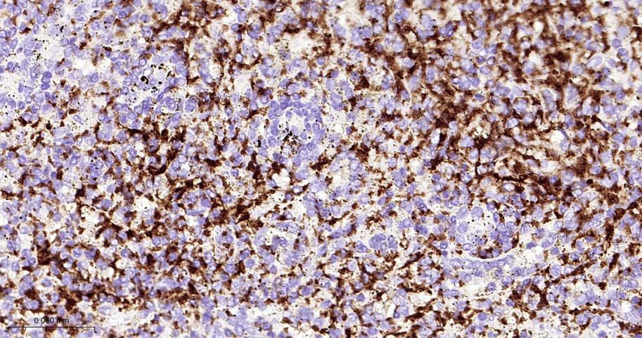 血小板膜糖蛋白Ⅱb（CD41）重组兔单抗-bsm-52912R