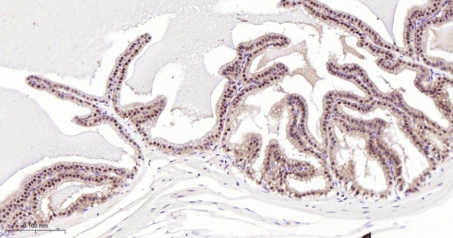 环指蛋白75重组兔单抗-bsm-60704R