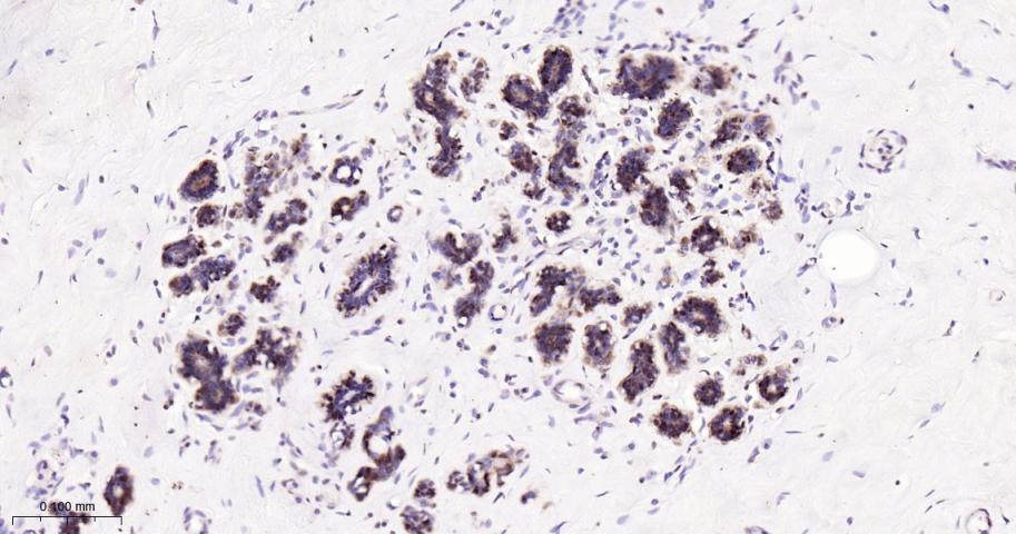 环指蛋白75重组兔单抗-bsm-60704R