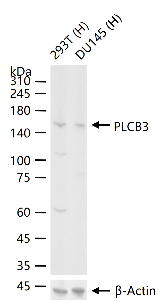 磷酯酶Cβ3重组兔单抗-bsm-62935R