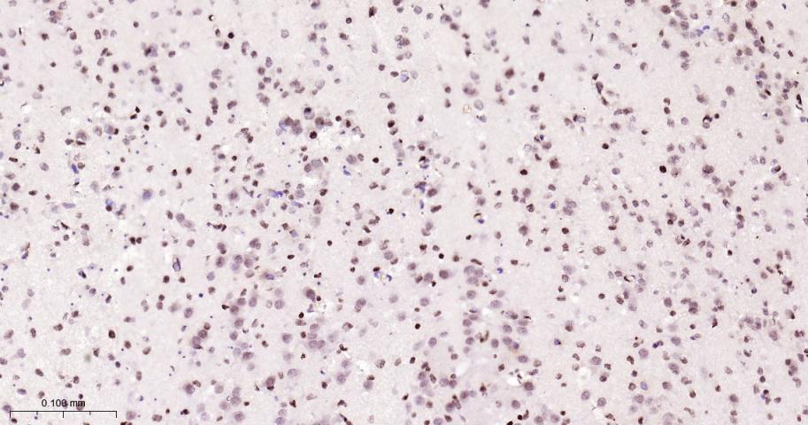 组蛋白H2A重组兔单抗-bsm-63133R