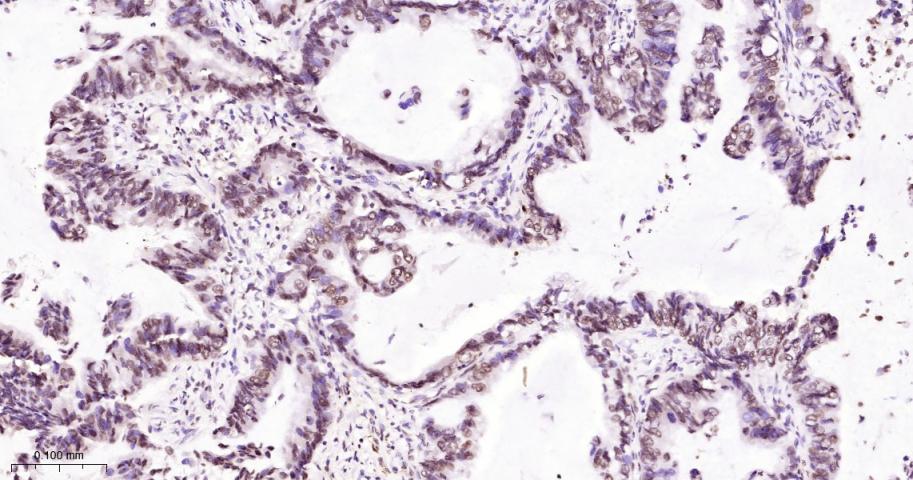 组蛋白H2A重组兔单抗-bsm-63133R