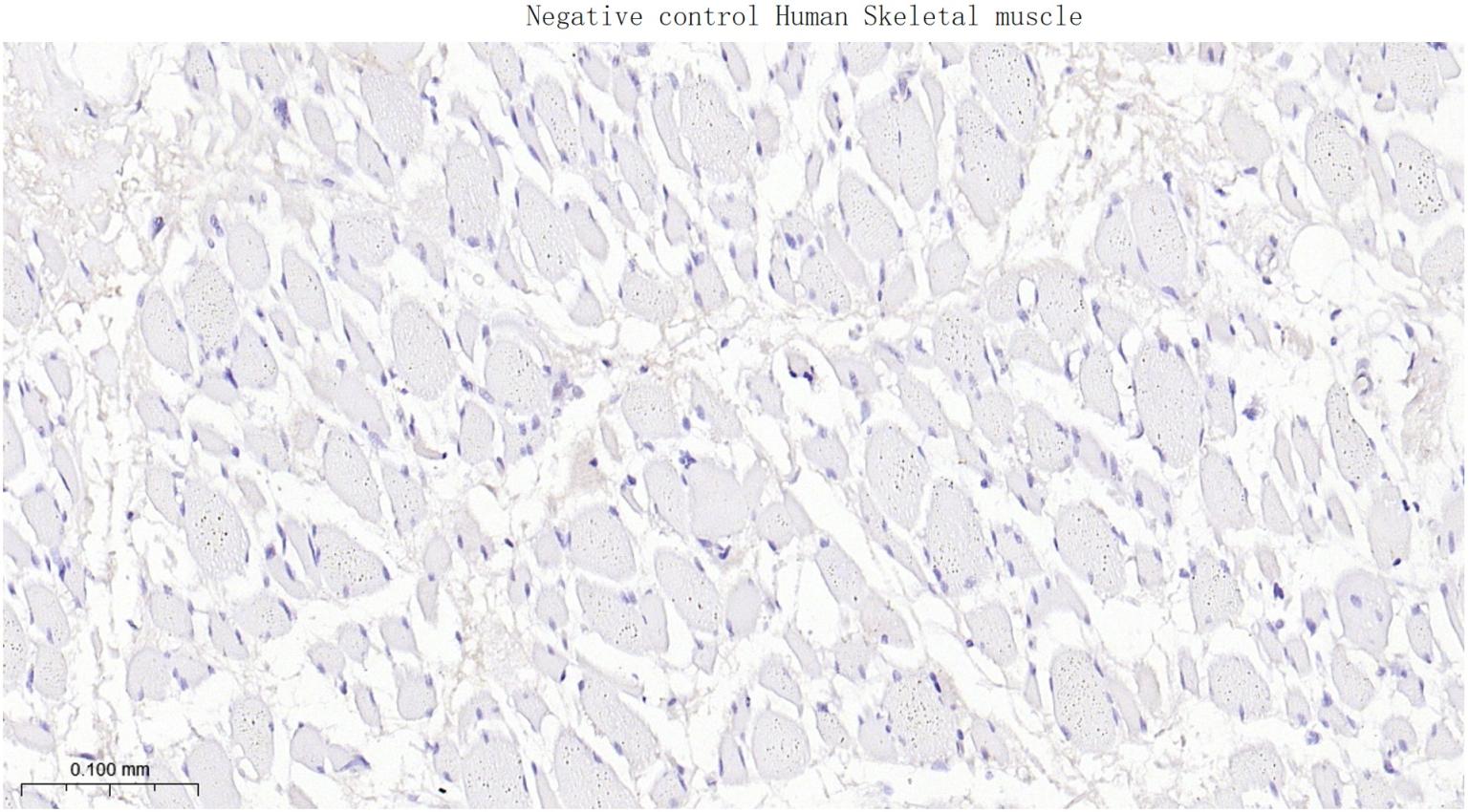 多配体蛋白聚糖1（CD138）重组兔单抗-bsm-60902R