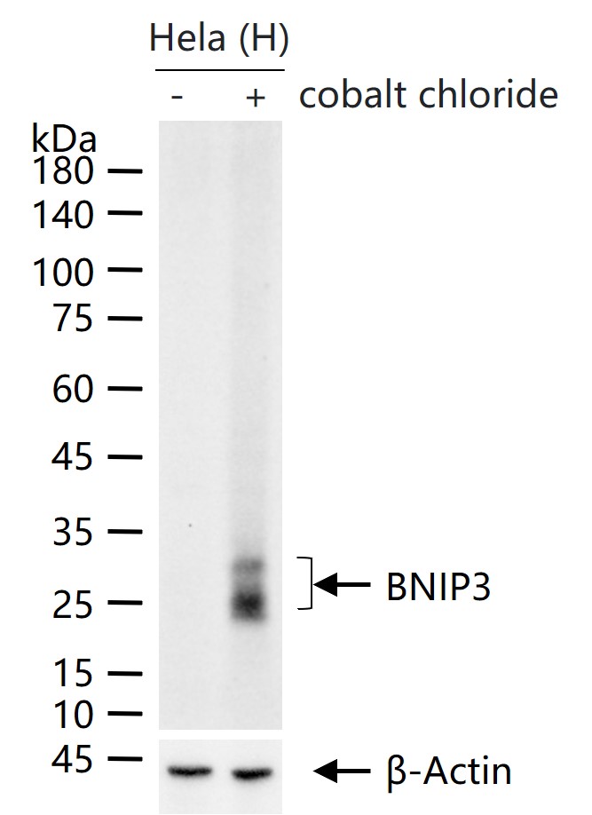 促凋亡调节蛋白BNIP3重组兔单抗-bsm-61440R