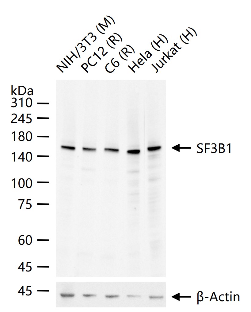 选择性剪接因子3B亚基1重组兔单抗-bsm-61871R