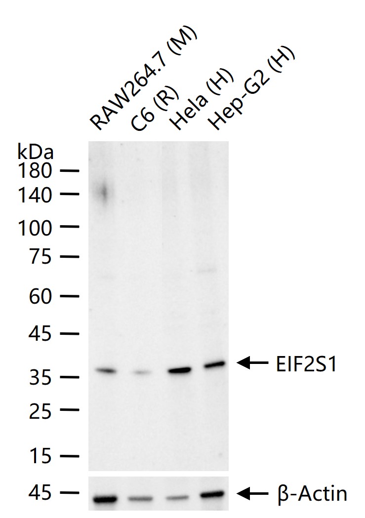 真核启动因子2α(eIFα2)兔单克隆抗体-bsm-60003R