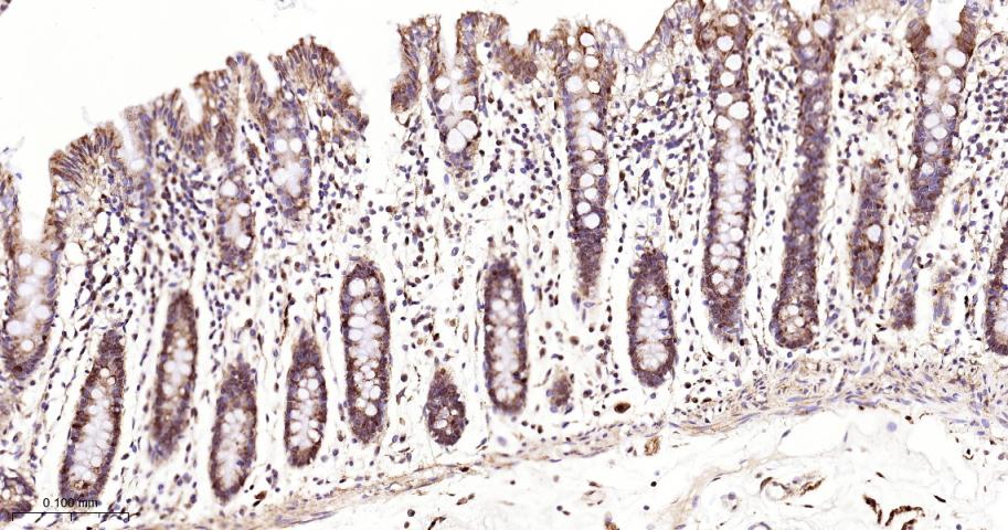 去泛素酶10重组兔单抗-bsm-61654R