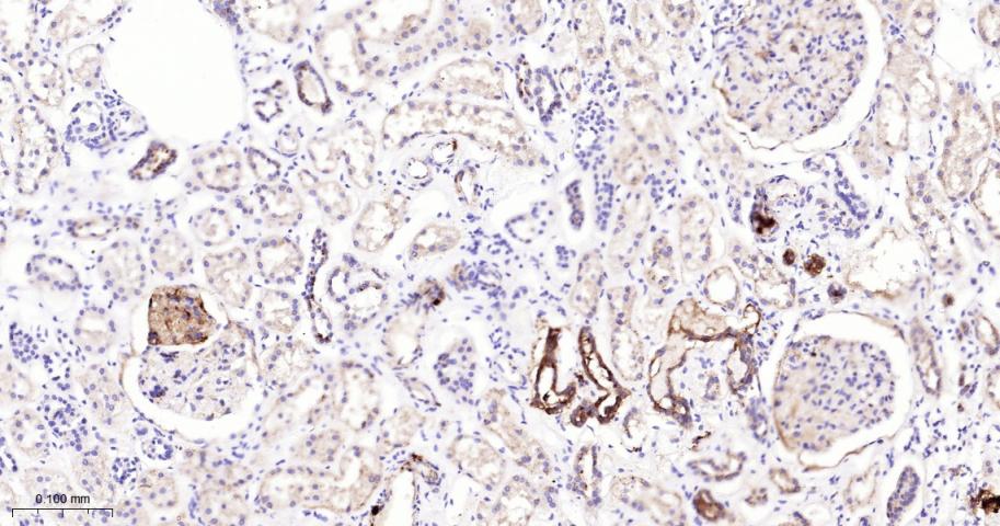 Rho GTP酶激活蛋白5重组兔单抗-bsm-62324R
