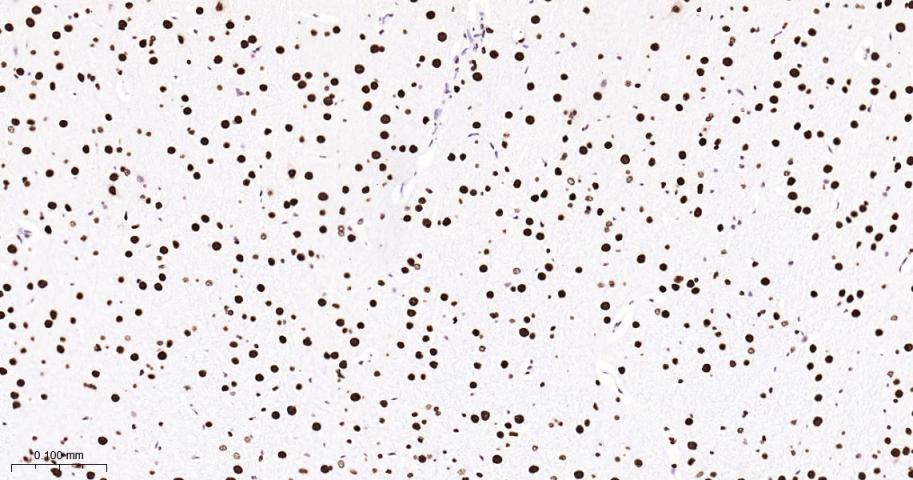 核基质蛋白3重组兔单抗-bsm-63230R