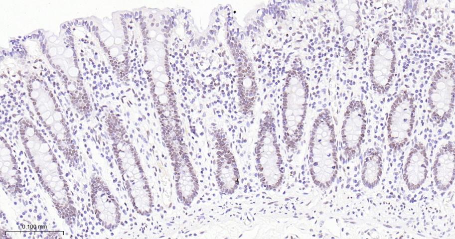 EHMT2重组兔单抗-bsm-61806R