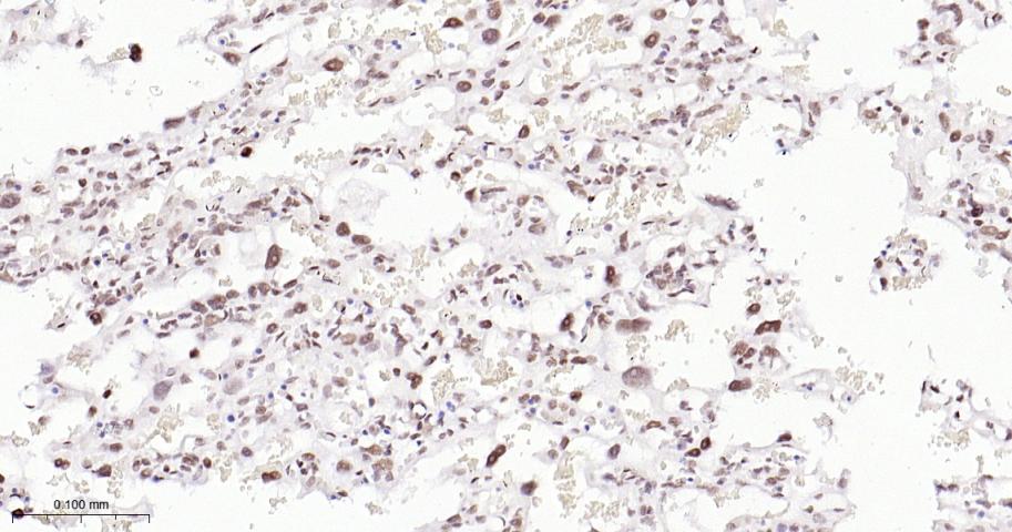 EHMT2重组兔单抗-bsm-61806R