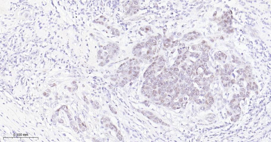 EHMT2重组兔单抗-bsm-61806R