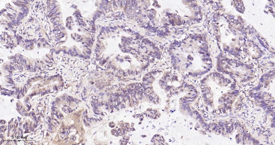 Rho GTP酶激活蛋白GAP重组兔单抗-bsm-62359R