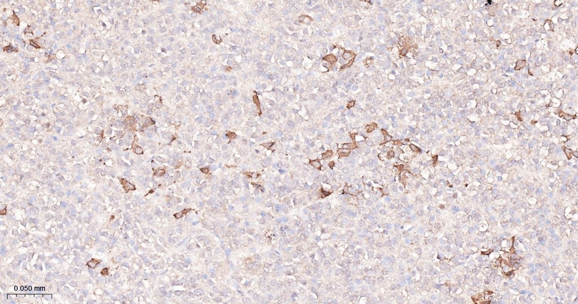 促甲状腺素β亚单位重组兔单抗-bsm-60432R