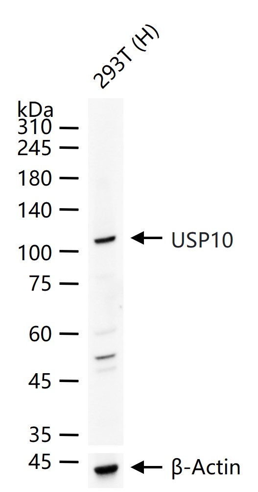 去泛素酶10重组兔单抗-bsm-61654R