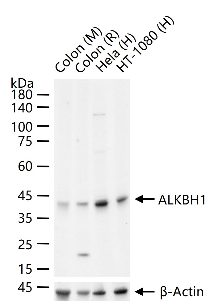 ALKBH1蛋白重组兔单抗-bsm-61168R