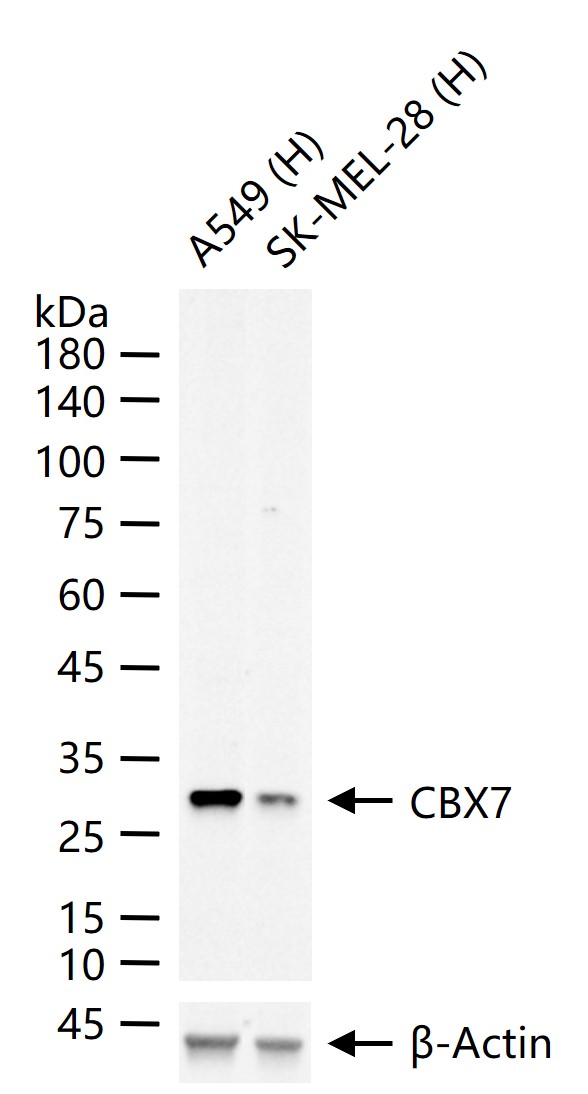 CBX7蛋白重组兔单抗-bsm-61683R