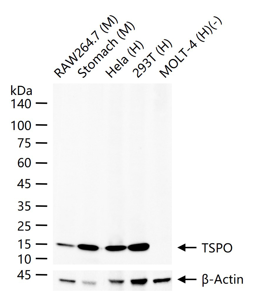 TSPO蛋白重组兔单抗-bsm-61187R