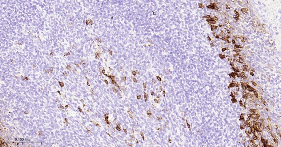 多配体蛋白聚糖1（CD138）重组兔单抗-bsm-60902R
