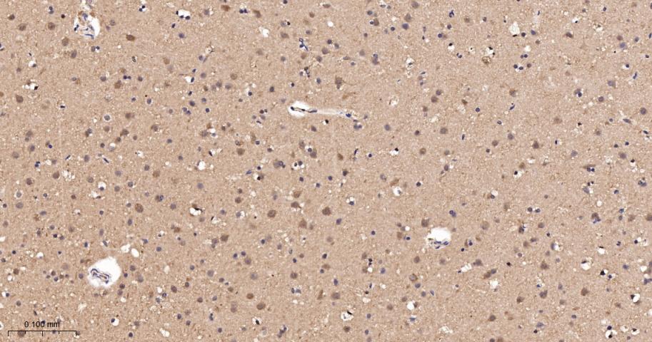 磷酯酶Cβ3重组兔单抗-bsm-62935R