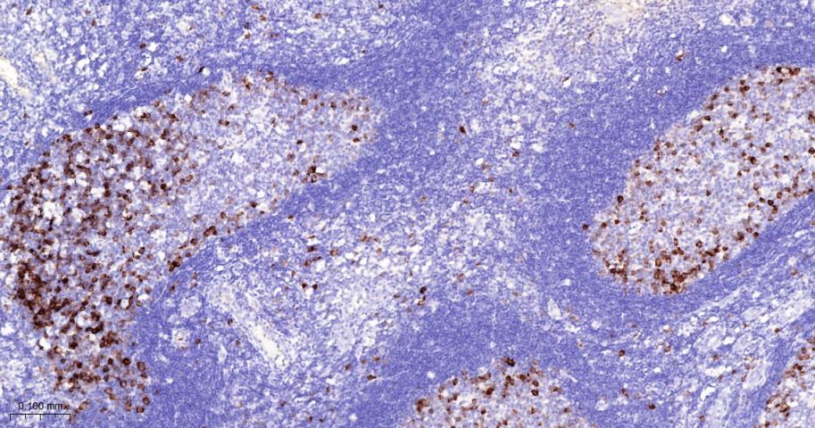 周期素B1重组兔单抗-bsm-63333R