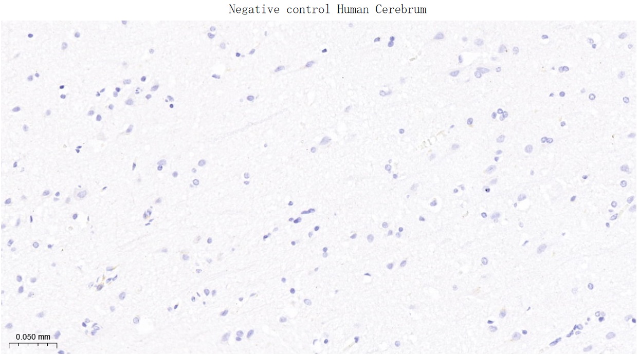 周期素B1重组兔单抗-bsm-63333R