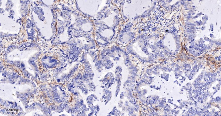 CD276重组兔单抗-bsm-61503R