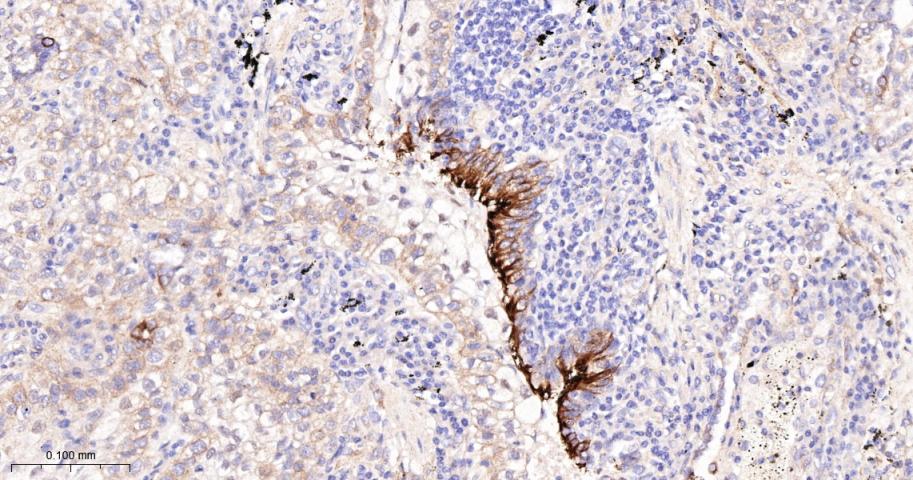 CD276重组兔单抗-bsm-61503R