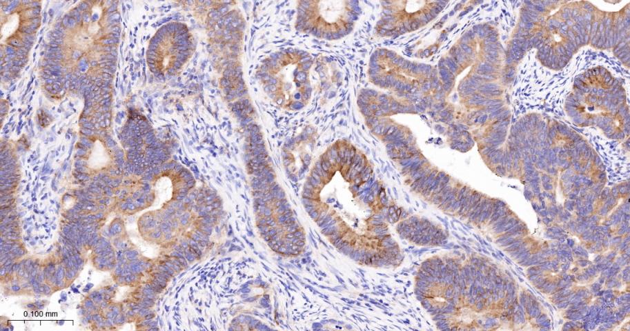 CD276重组兔单抗-bsm-61503R