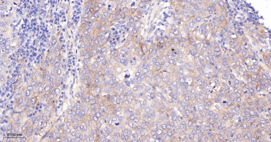 CD276重组兔单抗-bsm-61503R