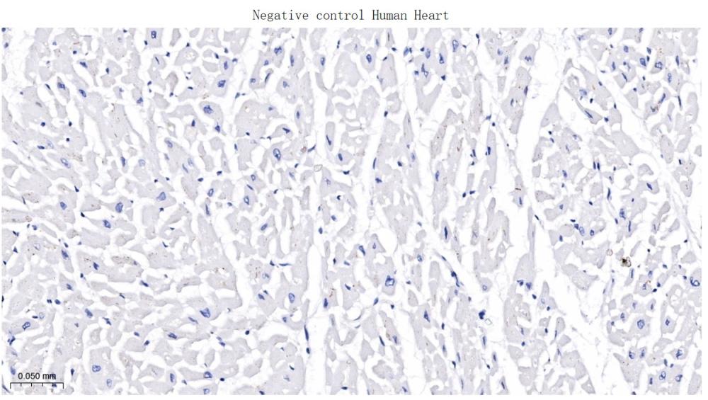 CD276重组兔单抗-bsm-61503R