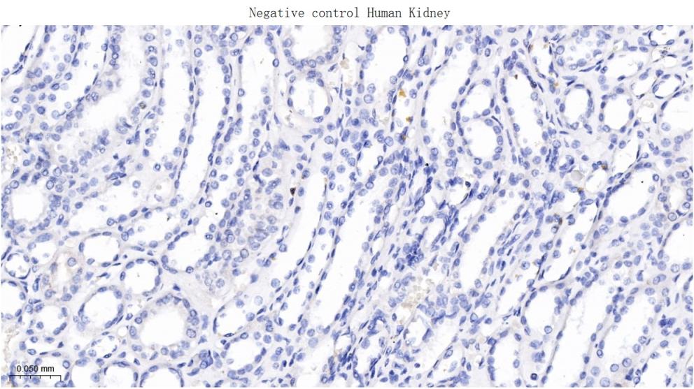 人绒毛膜促性腺激素β重组兔单抗-bsm-43172R