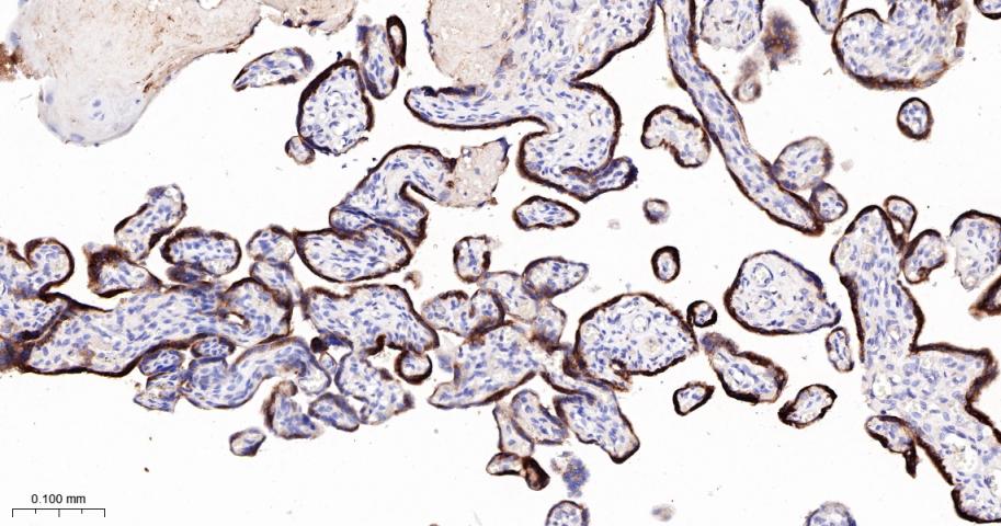 人绒毛膜促性腺激素β重组兔单抗-bsm-43172R