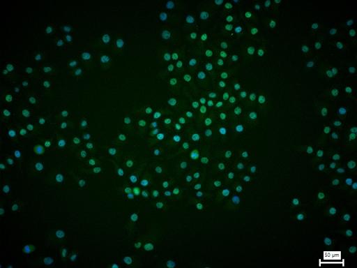 转录因子7类似物2重组兔单抗-bsm-52543R