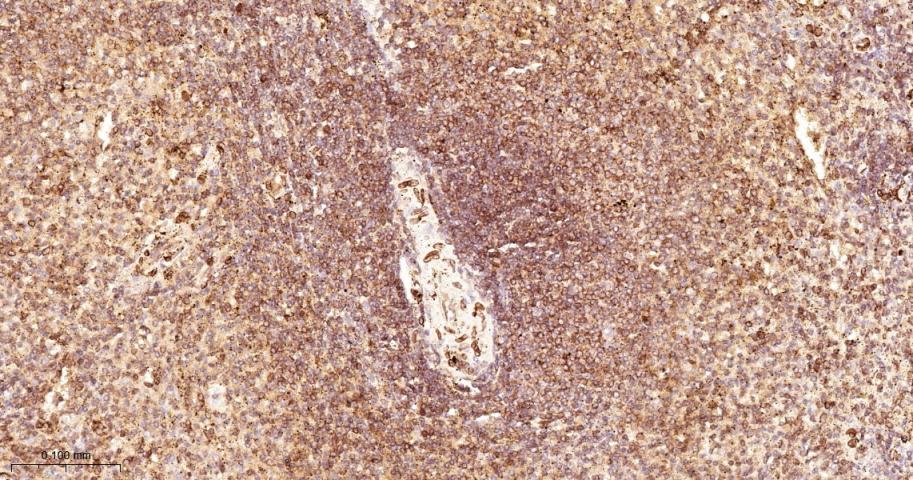 SUN2重组兔单抗-bsm-54421R