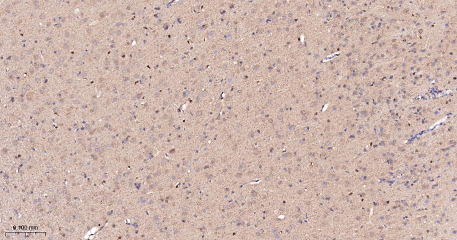 前列腺素氧化环化酶1重组兔单抗-bsm-61288R