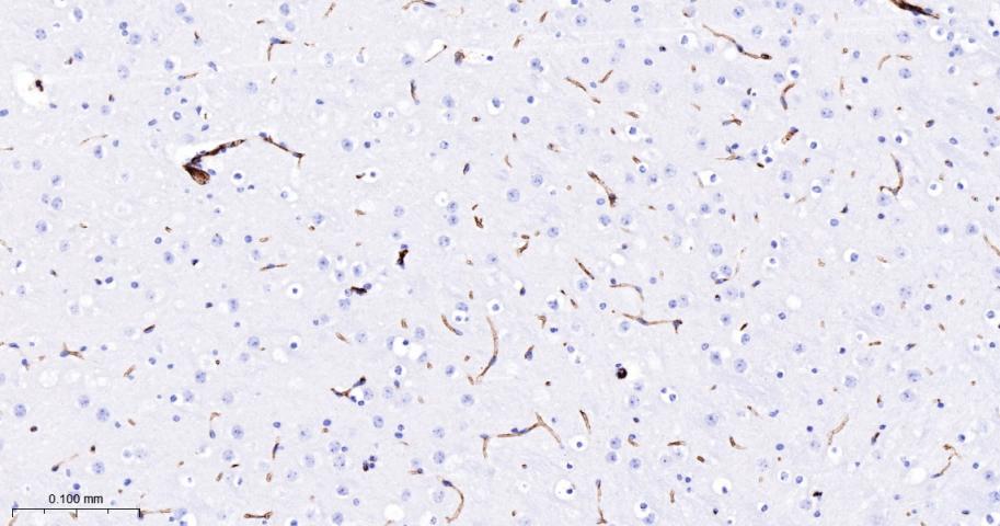 细胞间粘附分子-2（CD102）重组兔单抗-bsm-62574R