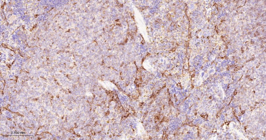 细胞间粘附分子-2（CD102）重组兔单抗-bsm-62574R