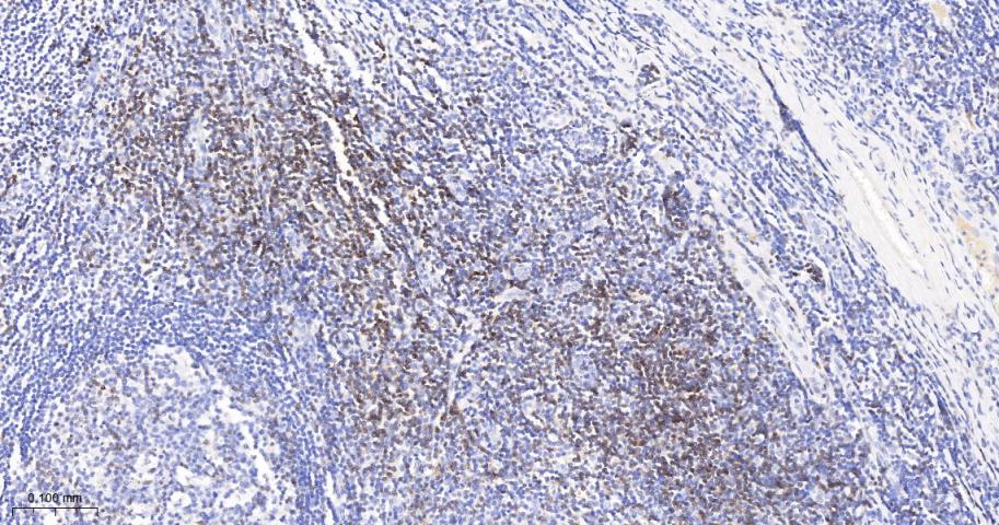 CD3D重组兔单抗-bsm-52744R
