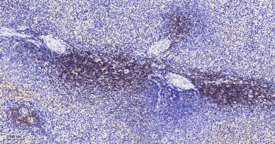 CD3D重组兔单抗-bsm-52744R