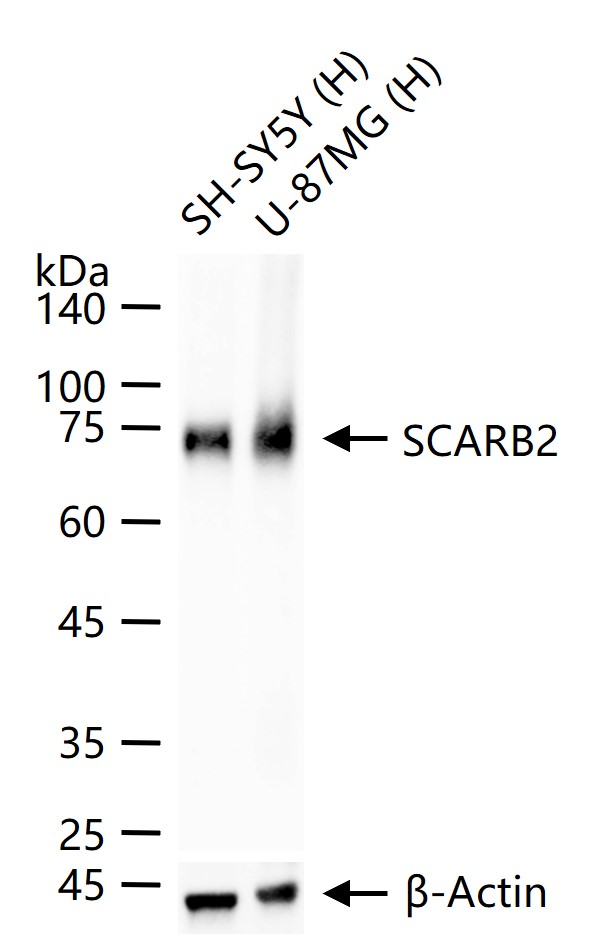 清道夫受体B2重组兔单抗-bsm-62192R