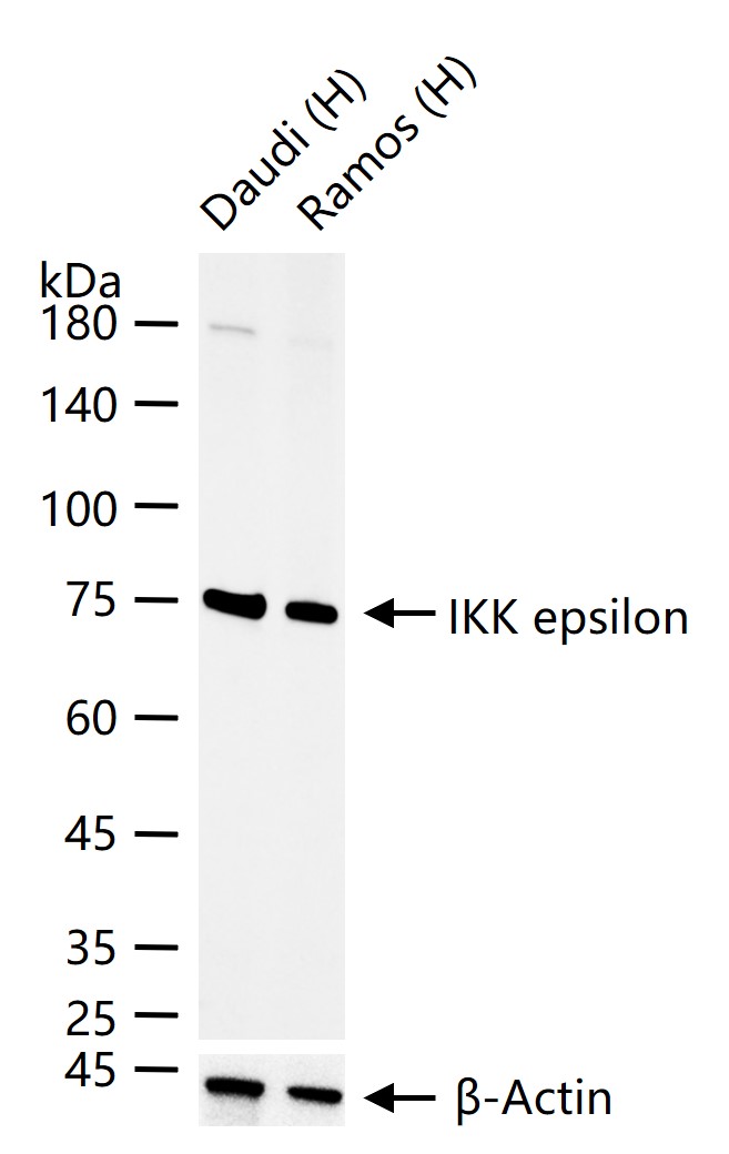 核因子κB抑制蛋白E重组兔单抗-bsm-61720R