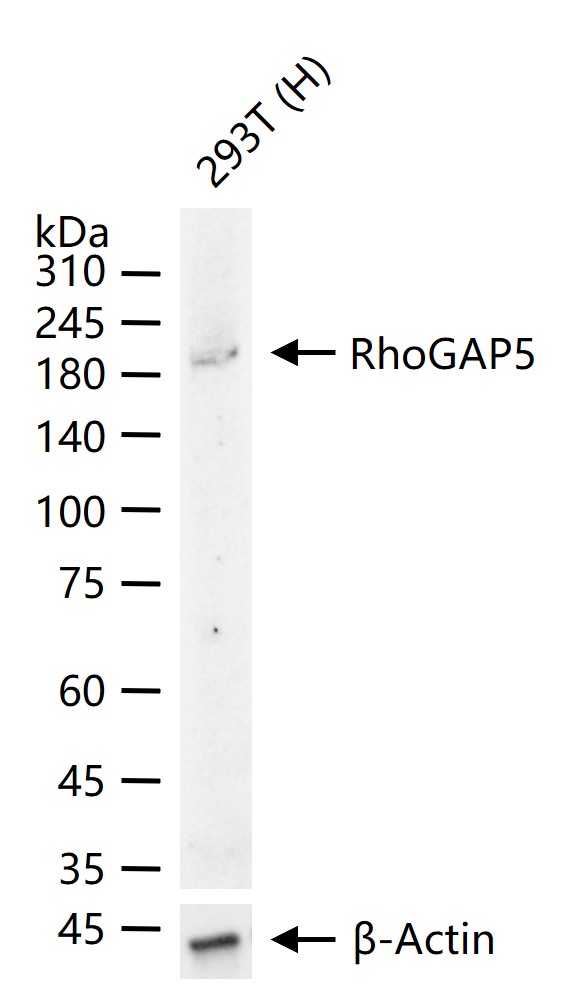 Rho GTP酶激活蛋白5重组兔单抗-bsm-62324R
