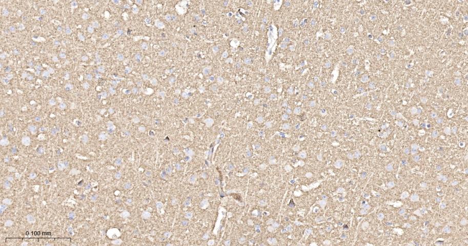 突触小泡蛋白P38重组兔单抗-bsm-52379R