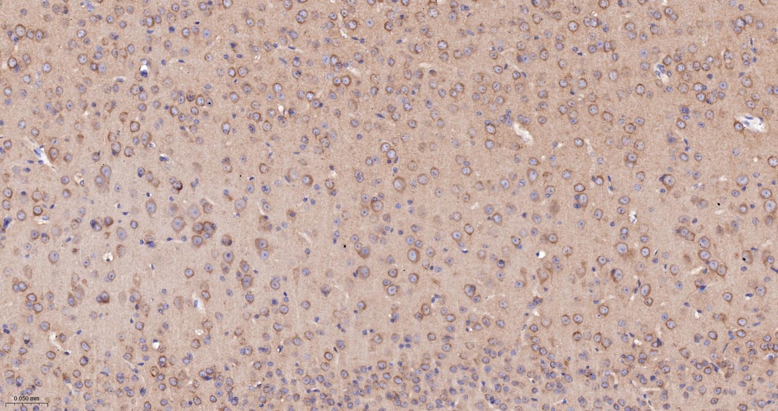 泛素结合蛋白P62重组兔单抗-bsm-60709R