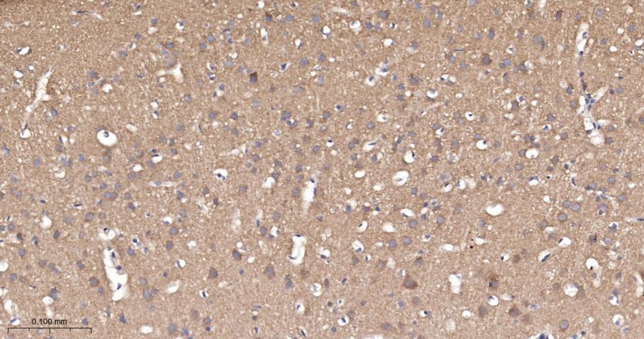 泛素结合蛋白P62重组兔单抗-bsm-60709R