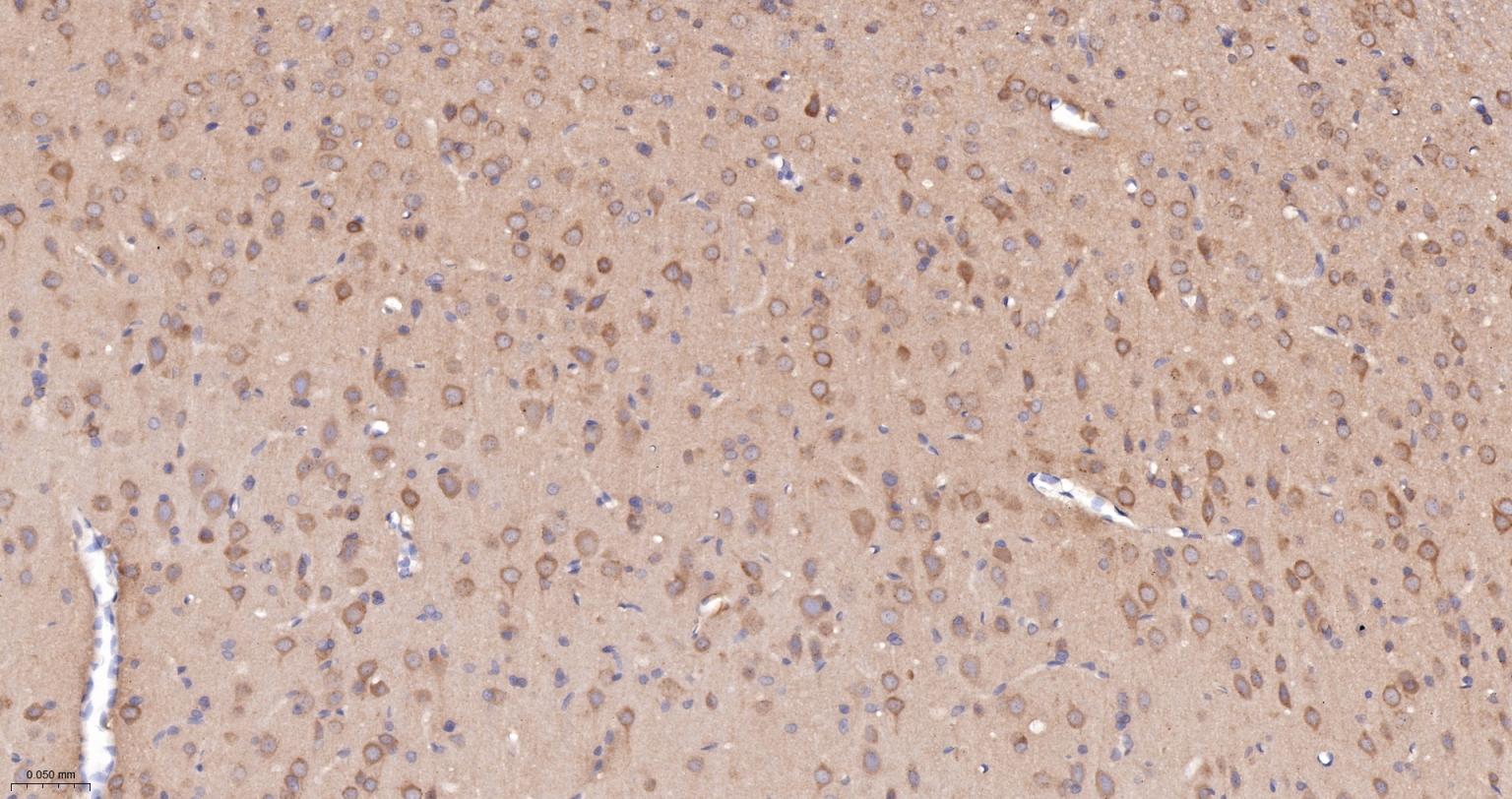 泛素结合蛋白P62重组兔单抗-bsm-60709R