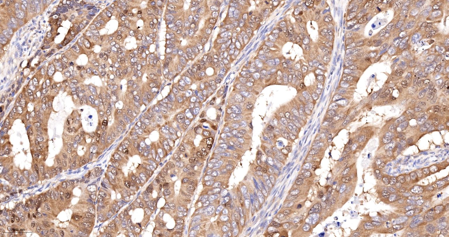 泛素结合蛋白P62重组兔单抗-bsm-60709R
