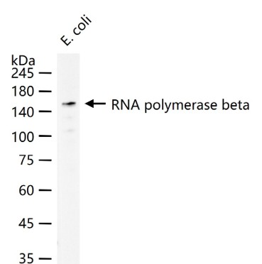 RNA聚合酶β重组兔单抗-bsm-61640R