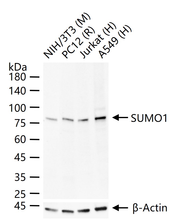 类泛素蛋白1重组兔单抗-bsm-61144R